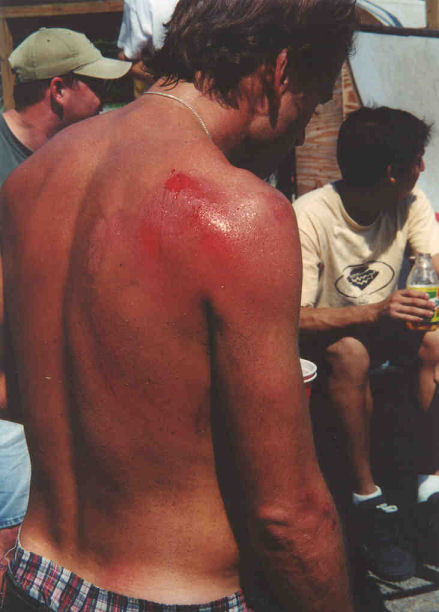 Tidwell shows the scars of street skating.....road rash